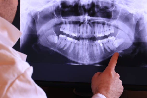 Best Emergency Treatment for Dental Infections or Abscesses in Foreman, AR
