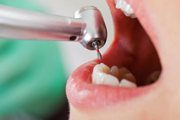 Best Emergency Treatment for Dental Infections or Abscesses in Foreman, AR